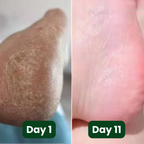 Murvano Antifungal Soap